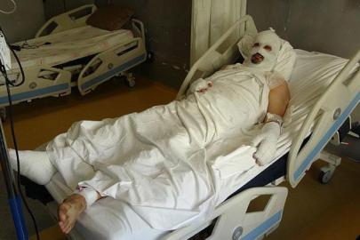 Hatay’da dehşet! Mumyaya döndü: Başımızın üstündeki lamba ve yerdeki telefon patladı